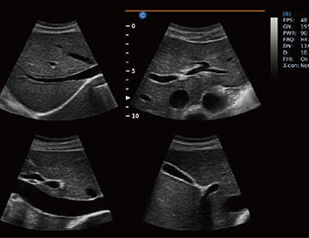 Abdomen, 4B Mode