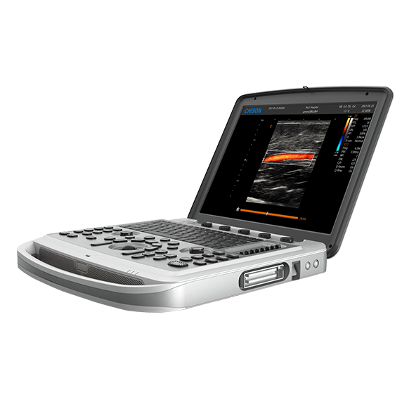 SonoBook 6